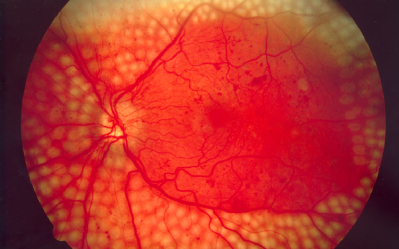 Google is using its deep learning tech to diagnose disease – And it performs (slightly) better than human doctors do